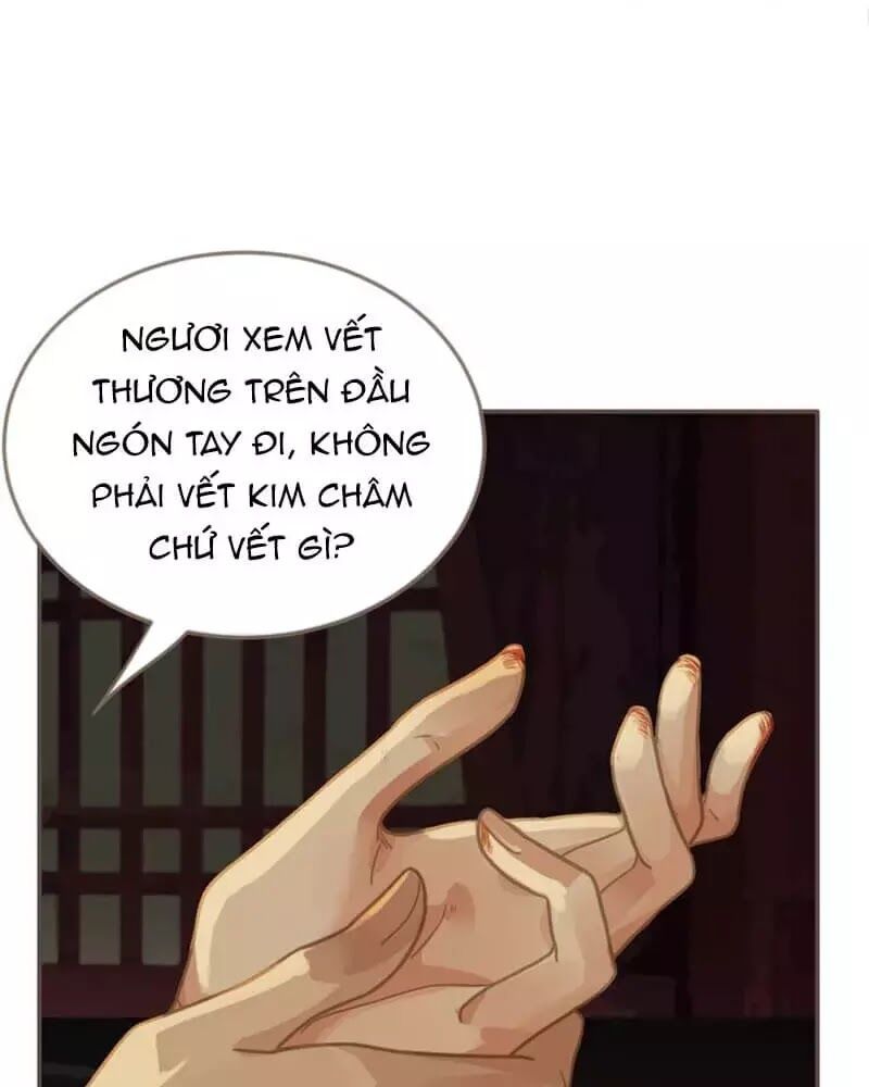 Nô Lệ Câm Chapter 7 - 30